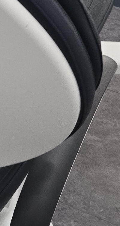 어금니 임플란트 안하면 후회하게 되는걸까 관련 이미지 40