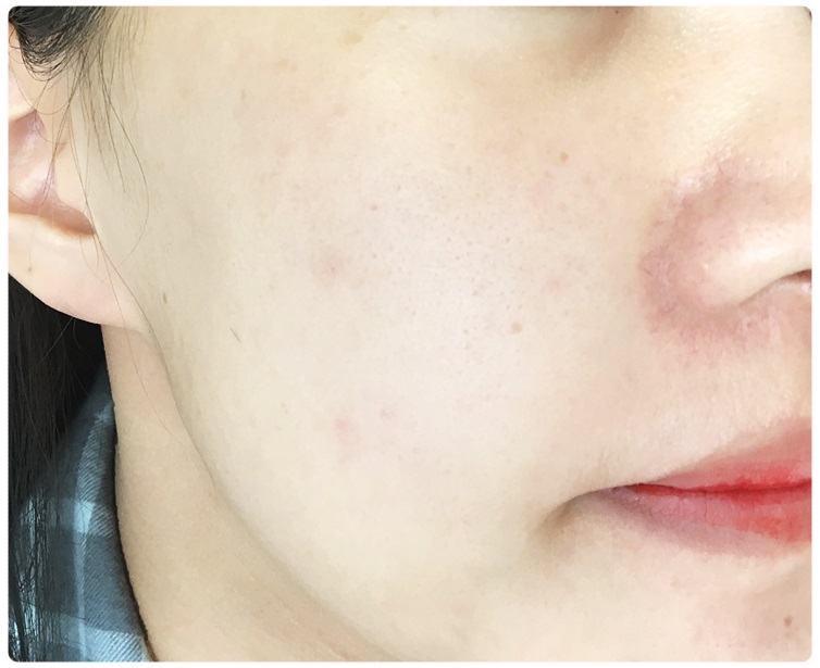 다크닝없는파운데이션 추천할게용 관련 이미지 8