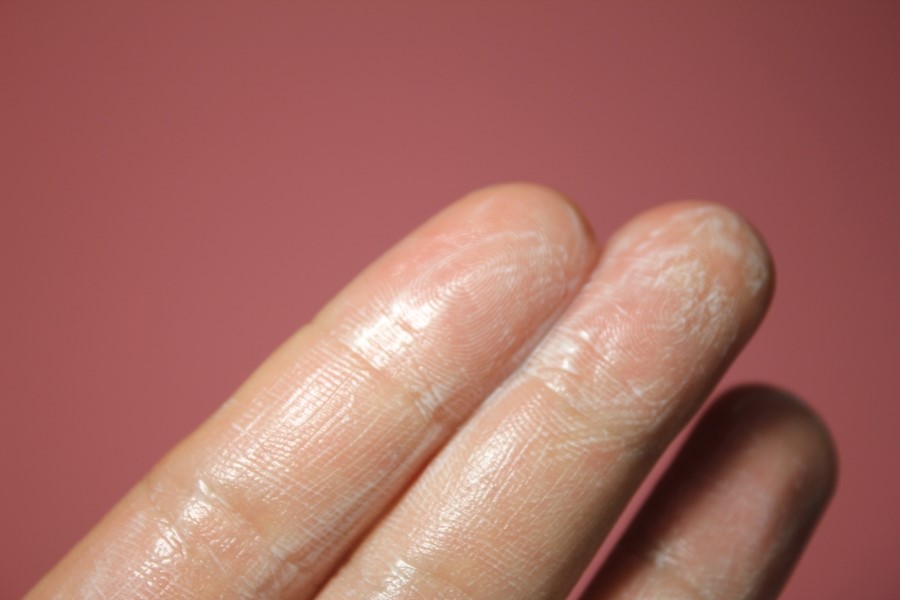 약산성세안제 완전 예민하신분들에게 관련 이미지 7