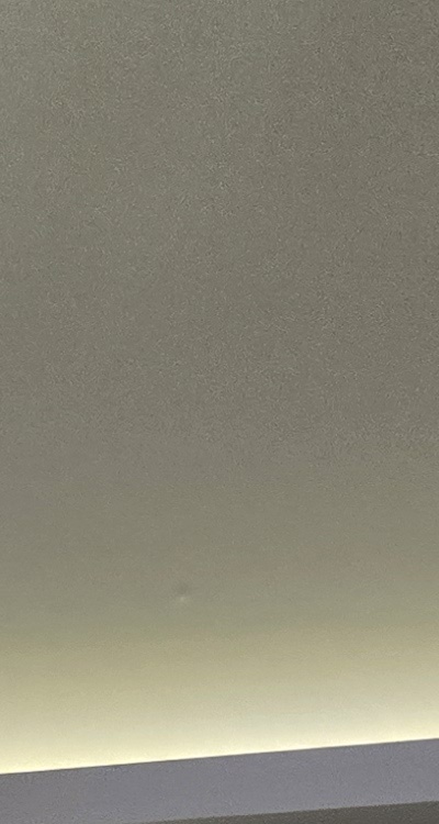 아래 사랑니 발치 통증 미리 알고 대처하려면 관련 이미지 16