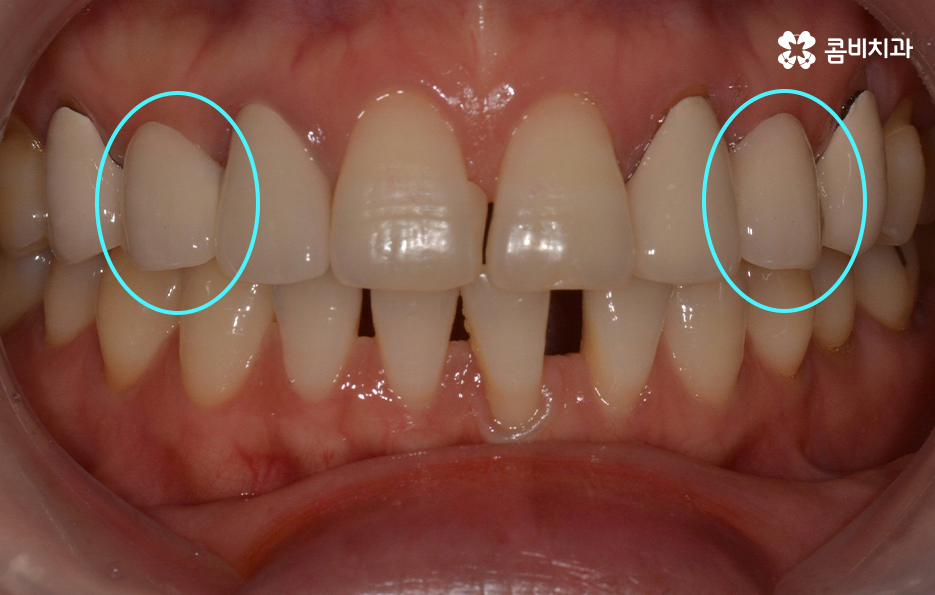 30대임플란트 향후 미래를 바라본다면 관련 이미지 2