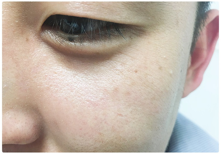 남자주름개선 쉽고 편리하게! 관련 이미지 7