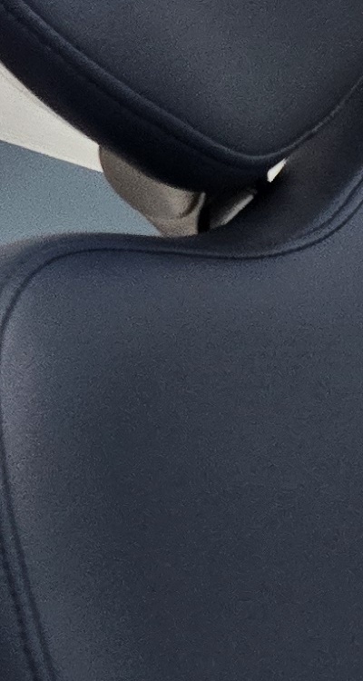 치아 사이 벌어짐 심해지는 이유부터 알아보면 관련 이미지 21