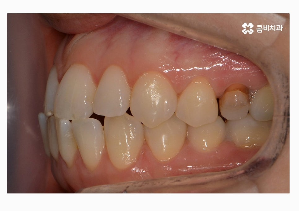 콤비교정 합리적으로 판단하려면 관련 이미지 3