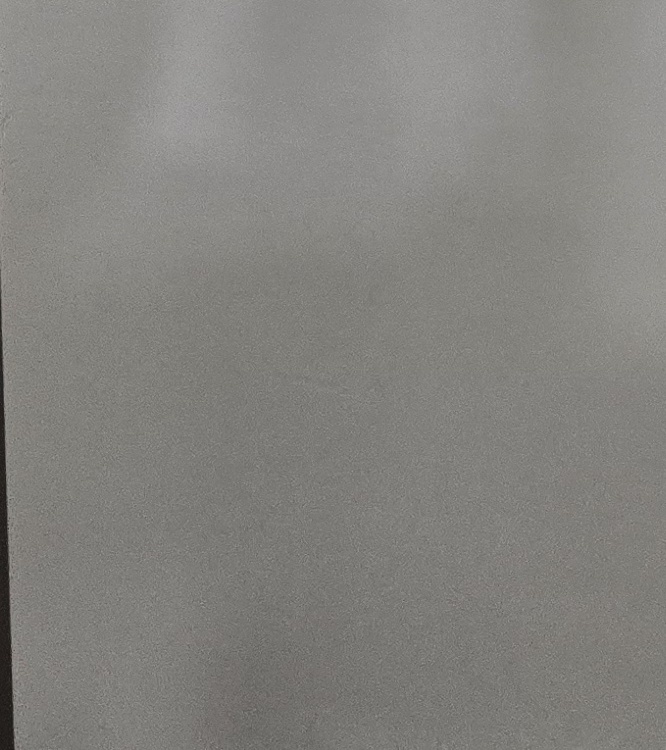 치경부마모증 치료 과정 신중하게 준비하려면 관련 이미지 32
