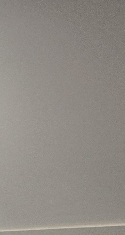 완전매복사랑니 발치 대학병원 꼭 가야하나요 관련 이미지 27