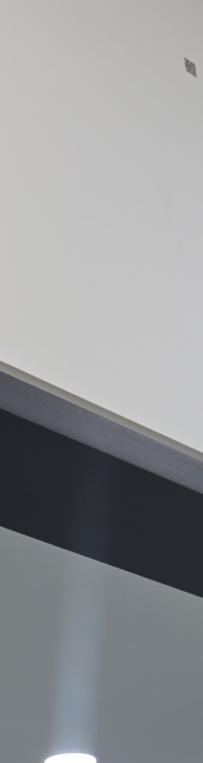 앞니 크라운 교체 깔끔하게 정리하려면 관련 이미지 14