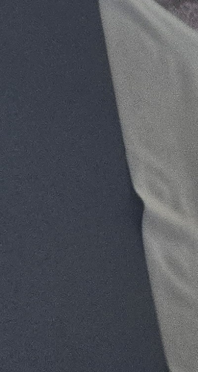 치아 사이 벌어짐 심해지는 이유부터 알아보면 관련 이미지 47