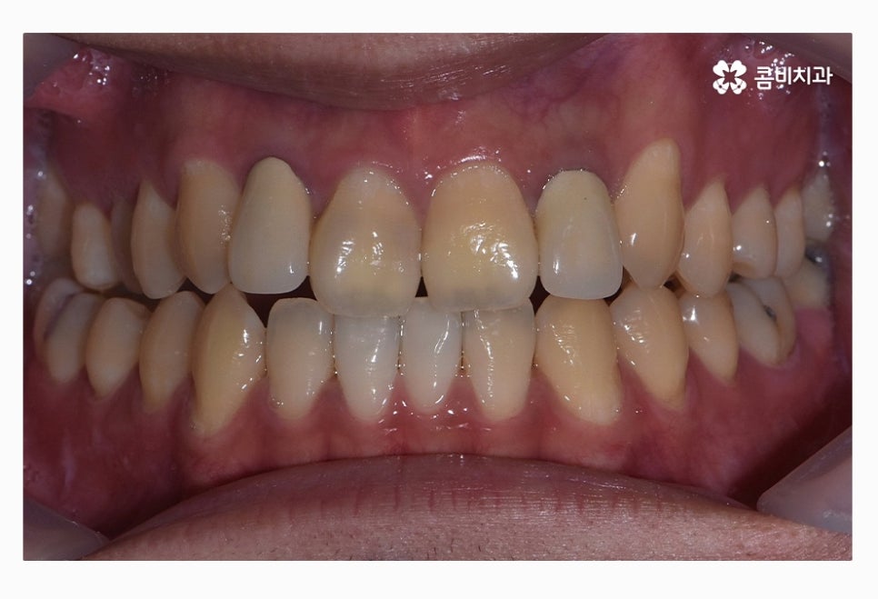 콤비교정 올바르게 판단하려면 관련 이미지 1