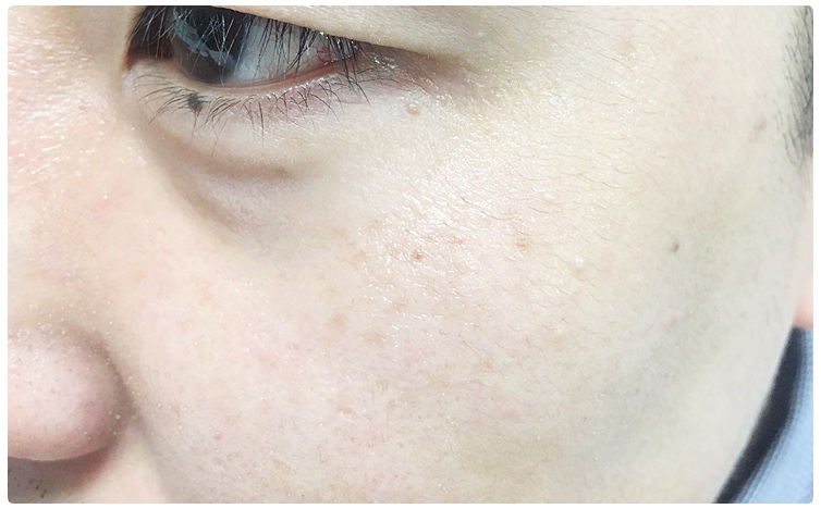 남자주름개선 쉽고 편리하게! 관련 이미지 11