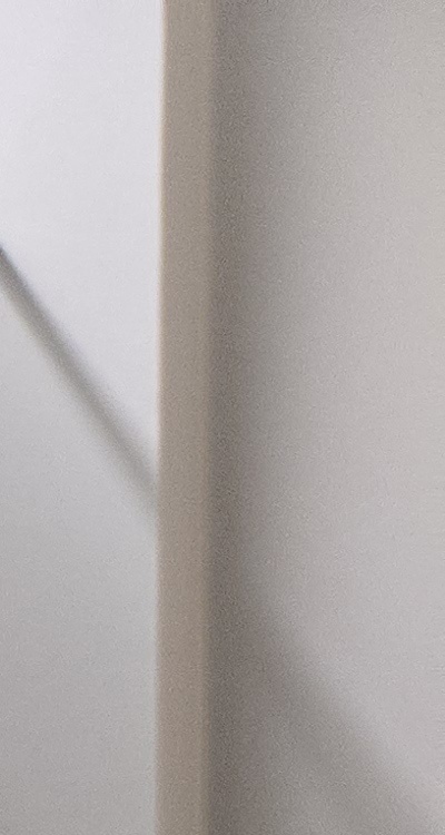 앞니 틀어짐 부분교정 얼마나 걸릴까 관련 이미지 20