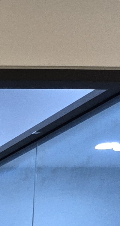 앞니 올세라믹 이건 알고 시작하세요 관련 이미지 18