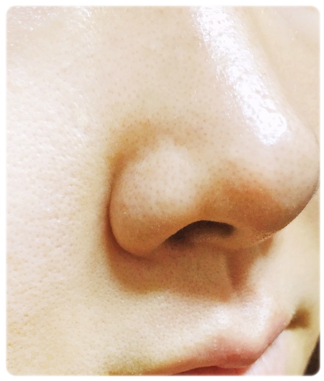 지성피부클렌징 꿀팁! 사우나광패드 관련 이미지 8