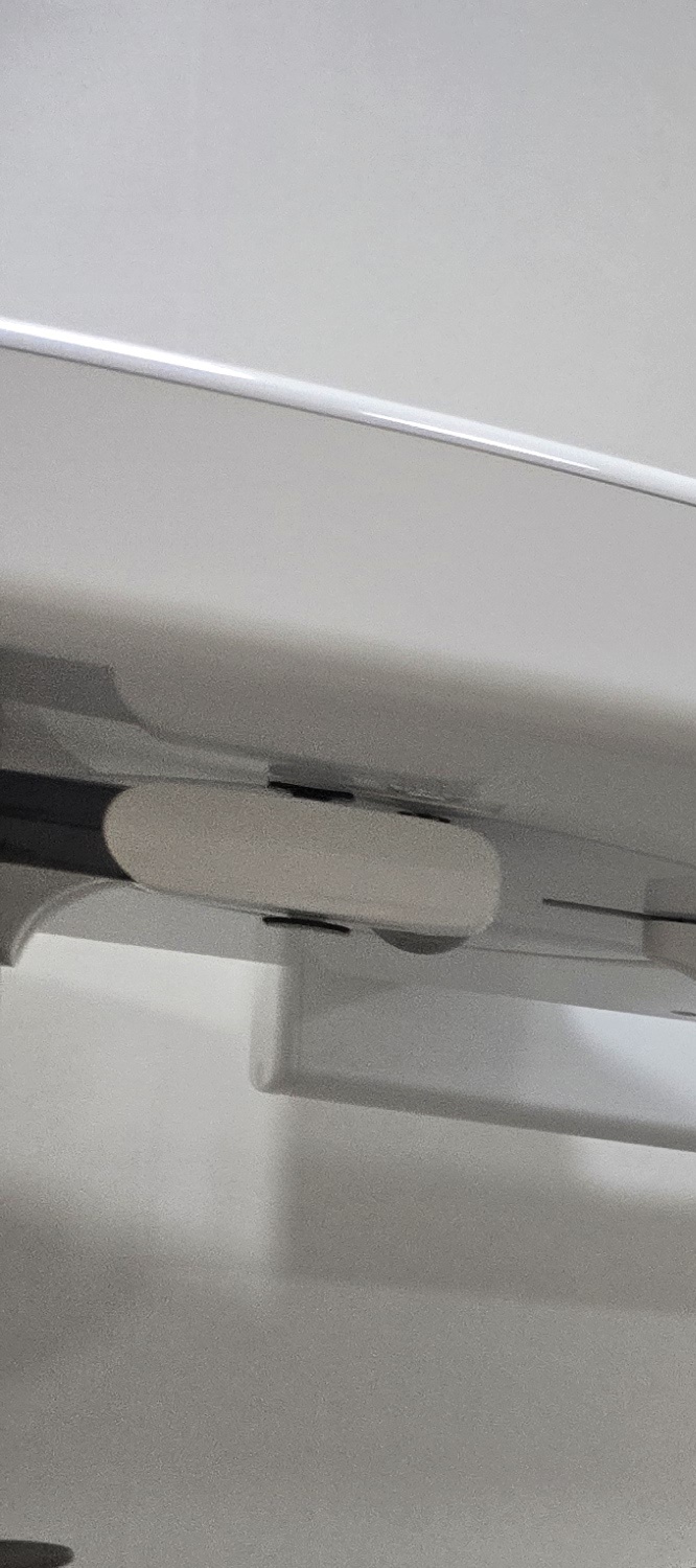 앞니 돌출 교정 기간 자세하게 따져보면 관련 이미지 28
