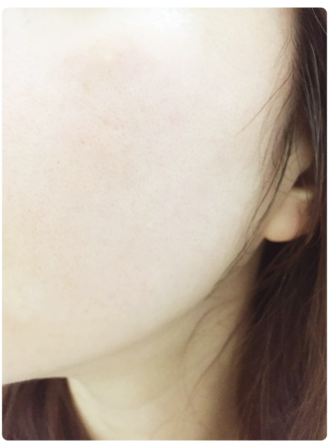 아이리무버 따로 안써도 됨 관련 이미지 5