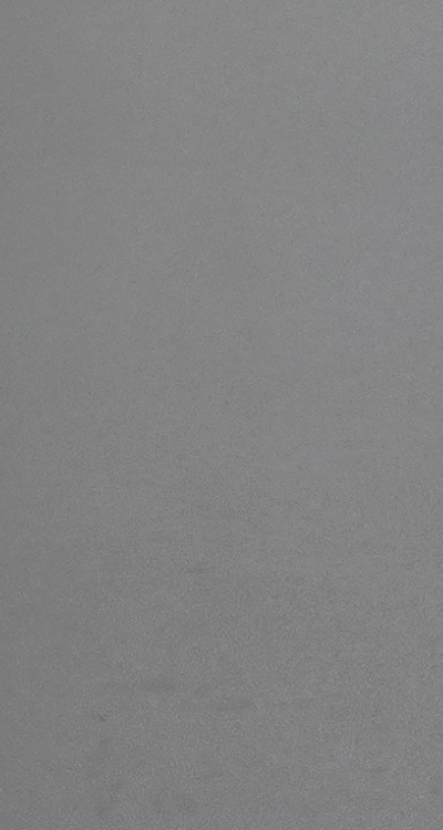 치아 발치 후 임플란트 언제부터 준비할까 관련 이미지 42