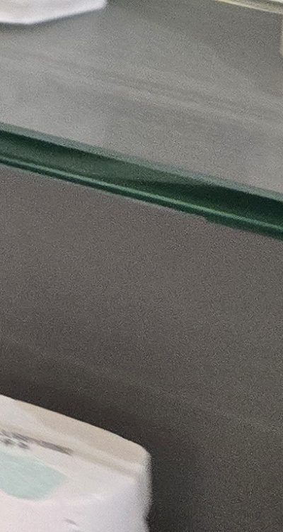 윗니 전체 임플란트 뭐부터 해야할까 관련 이미지 46