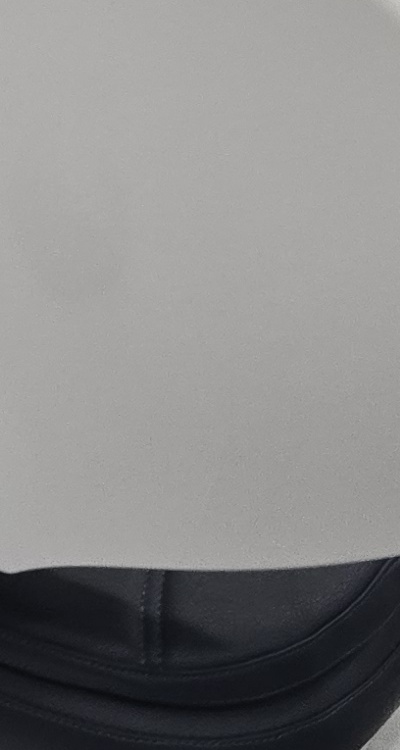 어금니 임플란트 안하면 후회하게 되는걸까 관련 이미지 39