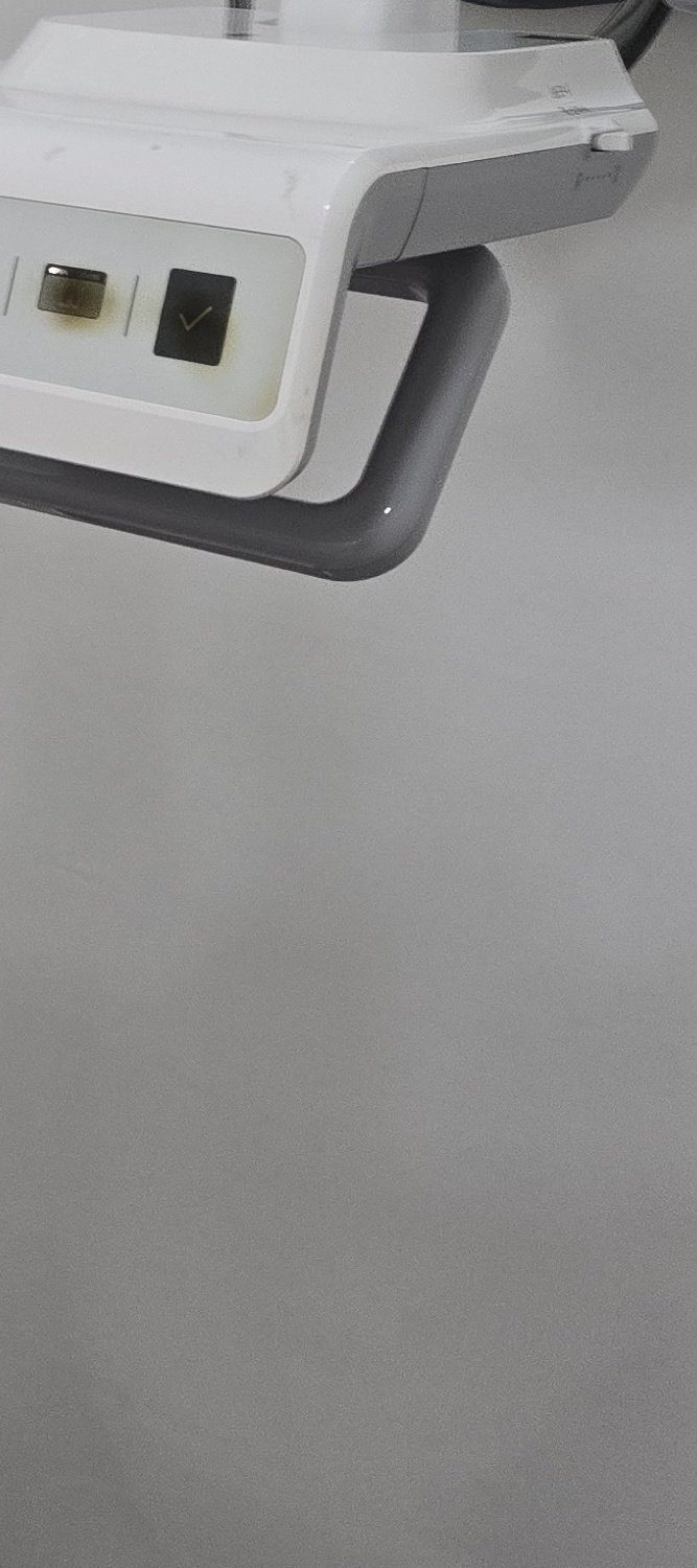 앞니 틀어짐 교정 이렇게 파악하세요 관련 이미지 32