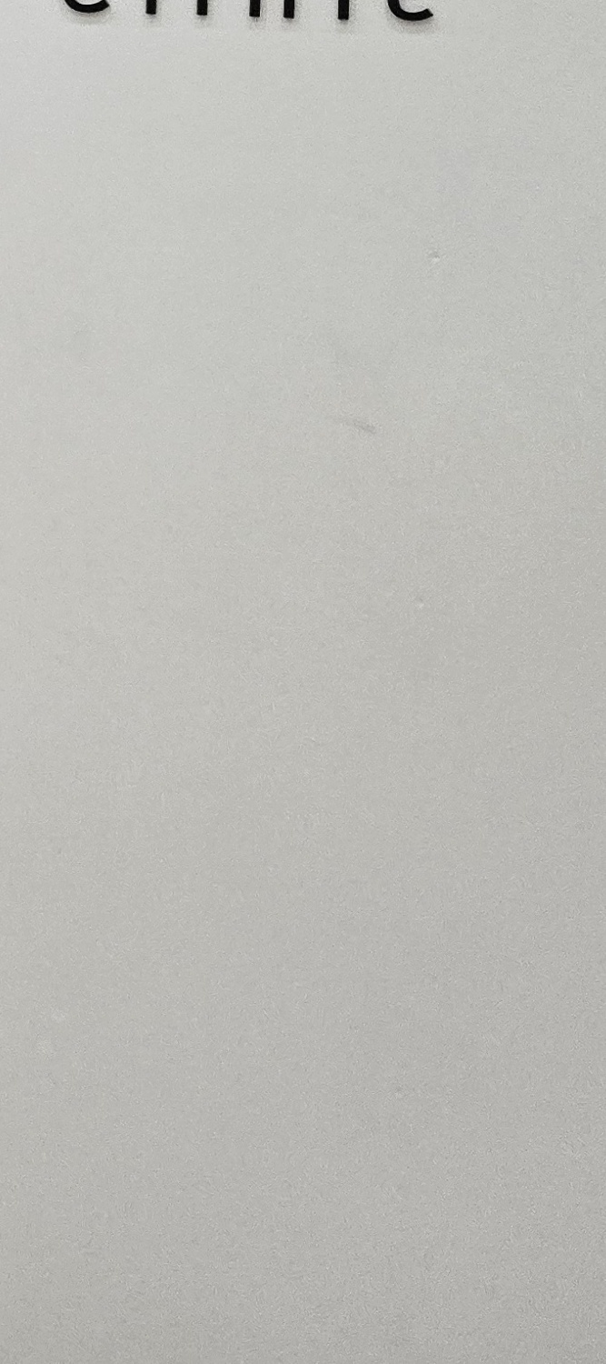 충치 치아 깨짐 시점이 관건이라면 관련 이미지 35