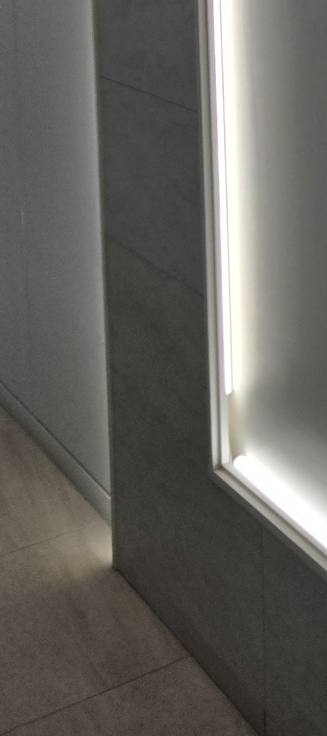 어금니 충치 단계 미리 알아차리려면 관련 이미지 20