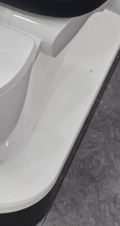 어금니 임플란트 안하면 후회하게 되는걸까 관련 이미지 49