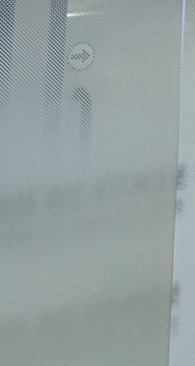 인레이 치료 후 통증 자꾸 심해지는데 괜찮은걸까 관련 이미지 44