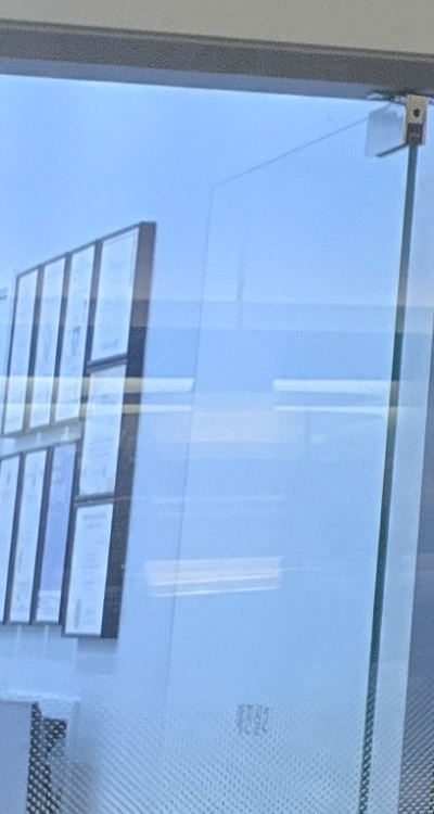 인레이 치료 후 통증 자꾸 심해지는데 괜찮은걸까 관련 이미지 33