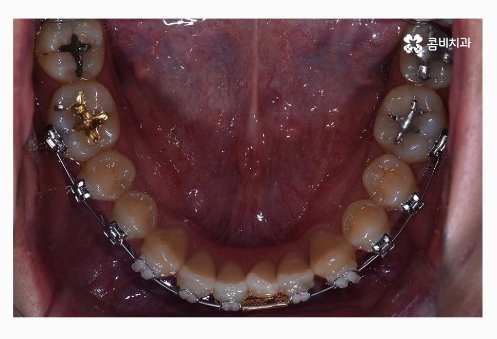 콤비교정 올바르게 판단하려면 관련 이미지 10