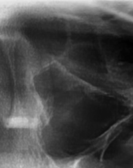 어금니 뒤 잇몸 부음 어떤 문제길래 이런거죠 관련 이미지 14