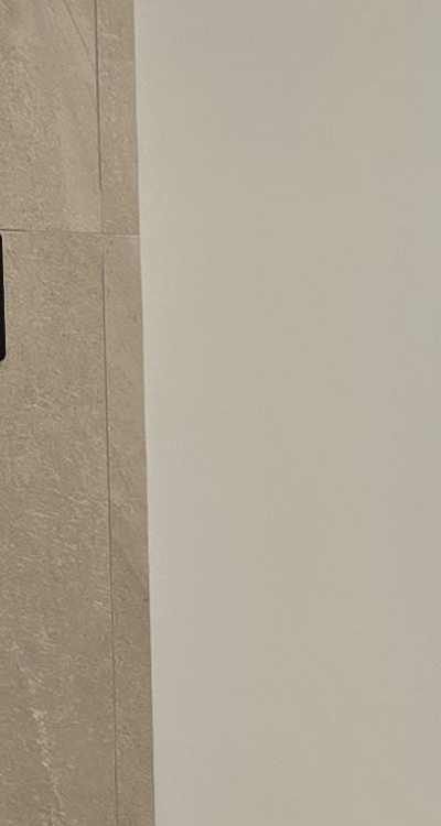 앞니 부분 교정 간단하니까 좋은건가요 관련 이미지 27