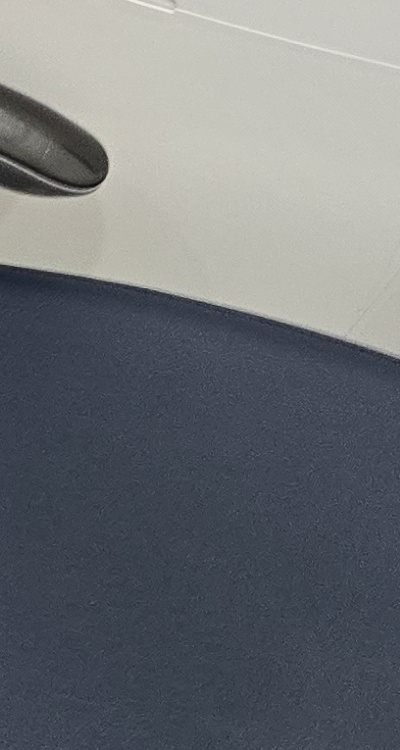 치아 사이 벌어짐 심해지는 이유부터 알아보면 관련 이미지 35