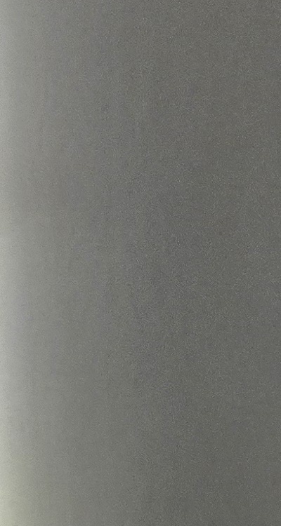 앞니 틀어짐 교정 조화롭게 마무리하려면 관련 이미지 19