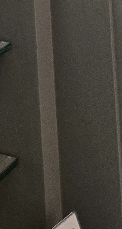 완전매복사랑니 발치 대학병원 꼭 가야하나요 관련 이미지 46