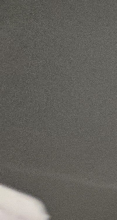 사랑니 주변 잇몸 통증 지금부터가 중요하니까 관련 이미지 12