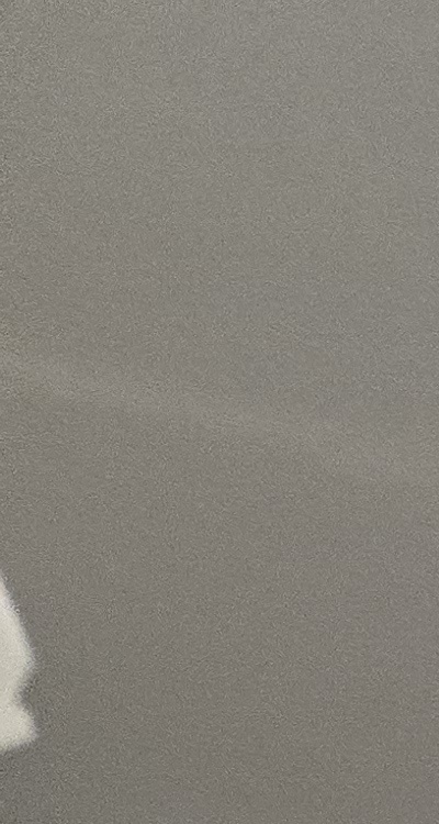 앞니 틀어짐 부분교정 얼마나 걸릴까 관련 이미지 11