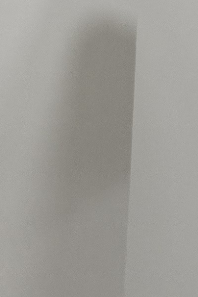 부정교합 교정 안하면 생기는 문제는 뭔가요 관련 이미지 29