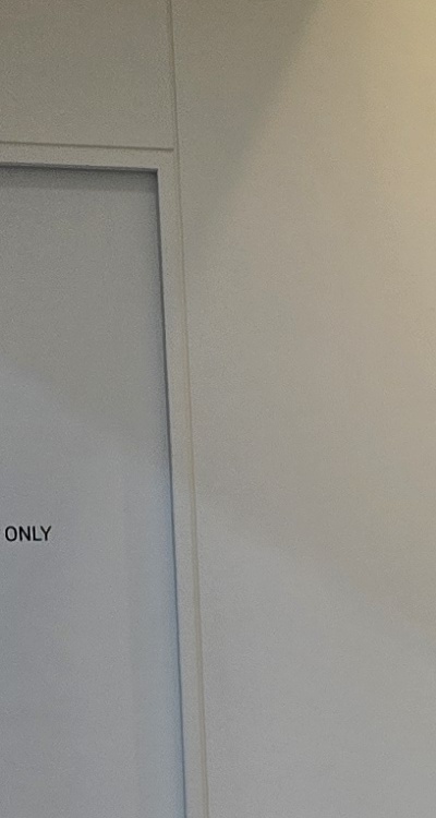 앞니 부분 교정 간단하니까 좋은건가요 관련 이미지 25