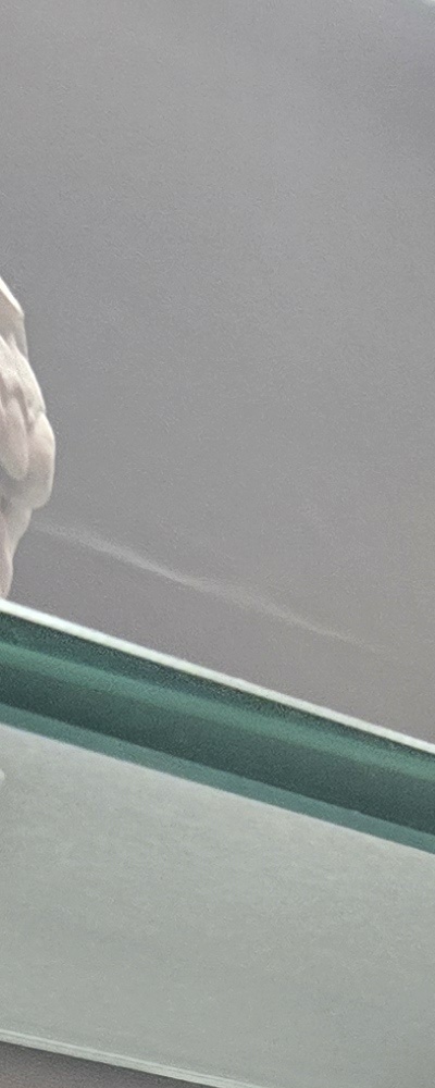 어르신 임플란트 지원 현명하게 활용하려면 관련 이미지 17