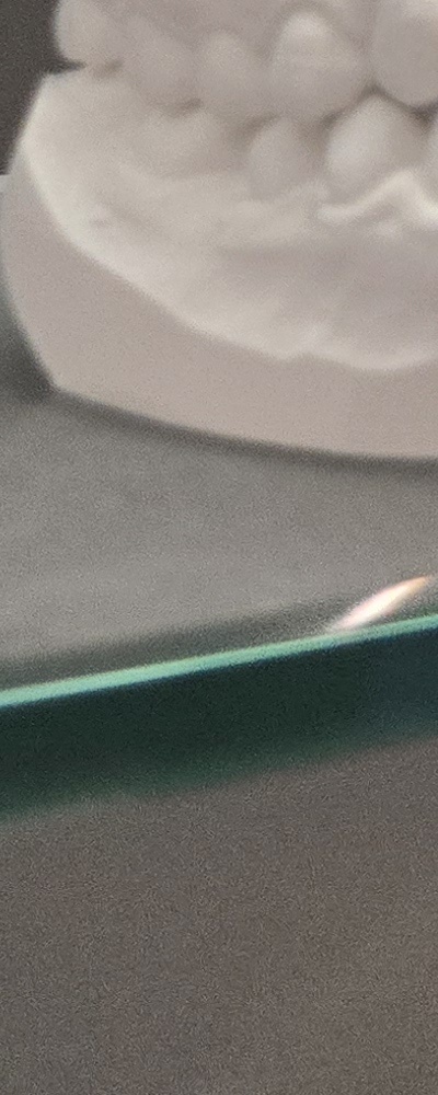 어르신 임플란트 지원 현명하게 활용하려면 관련 이미지 33