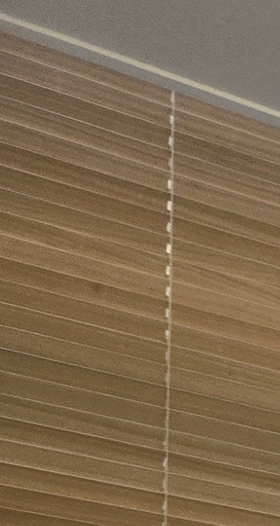 돌출입 팔자주름 교정 얼마나 바뀔까요 관련 이미지 12