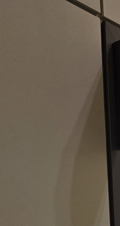 아말감 교체 레진 인레이 어떻게 대처하면 될까 관련 이미지 14