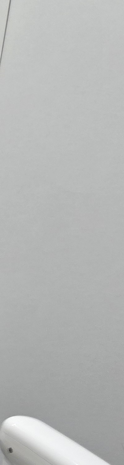 치과 치아미백 효과 어떤식으로 나타날까 관련 이미지 18