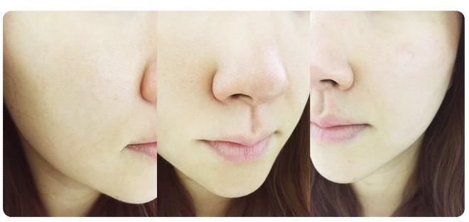 아이리무버 따로 안써도 됨 관련 이미지 6