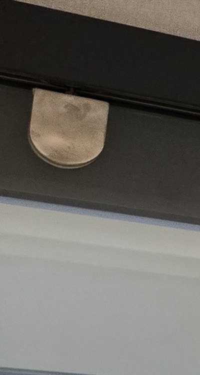 인레이 치료 후 통증 자꾸 심해지는데 괜찮은걸까 관련 이미지 22