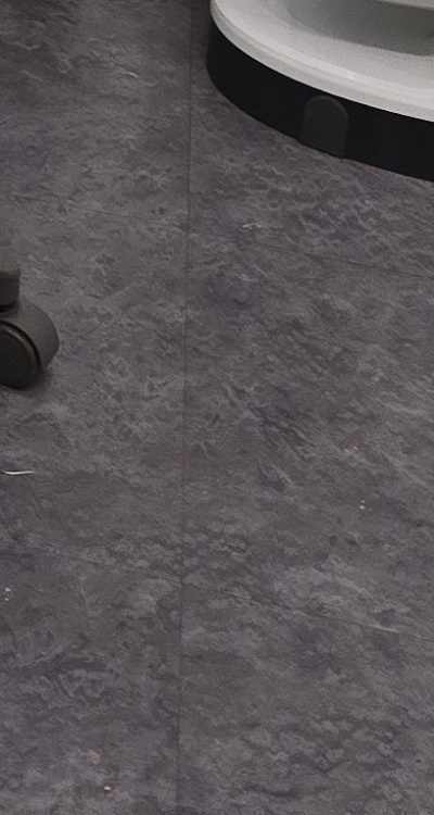 충치 검은점 나타났다면 이렇게 대처해요 관련 이미지 48