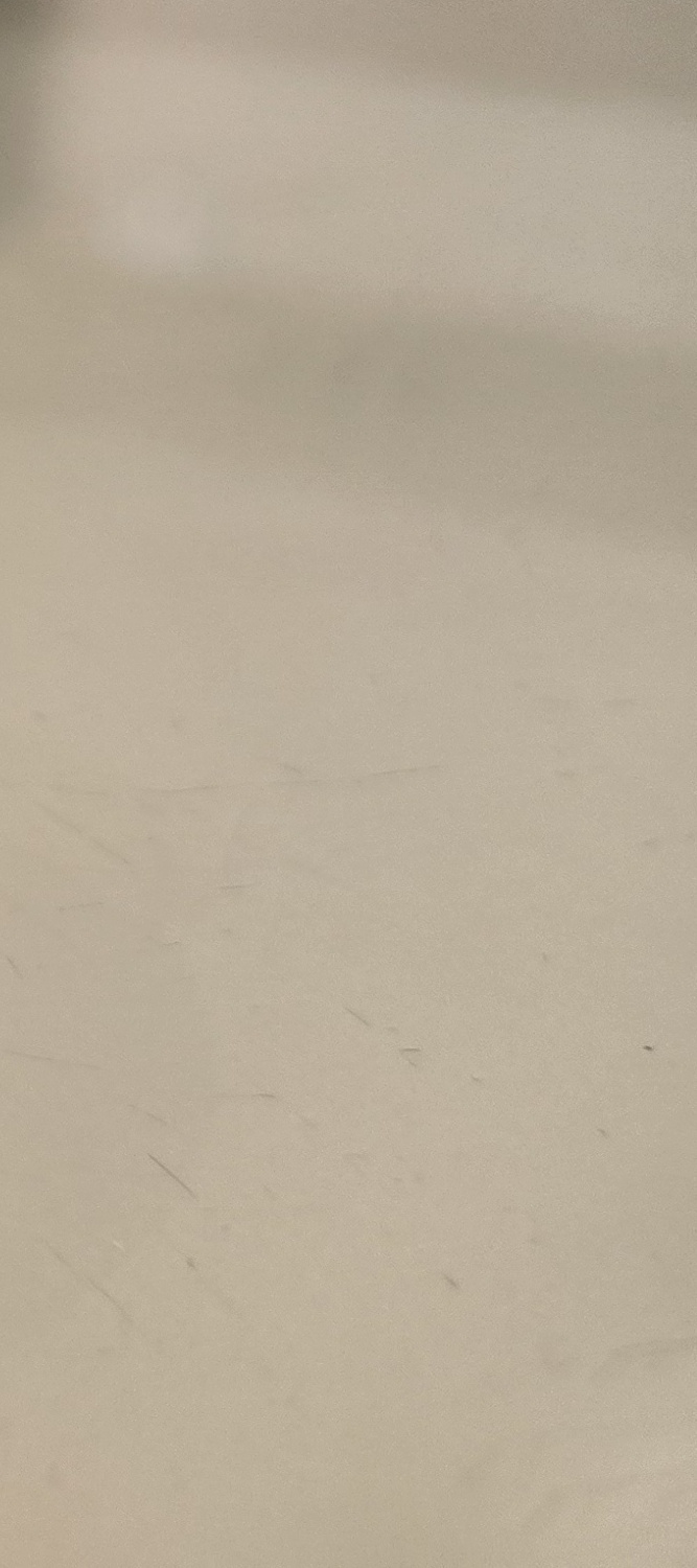 송곳니 덧니 발치 이럴때 해당되네요 관련 이미지 23