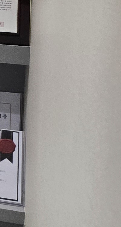 아래 사랑니 발치 통증 미리 알고 대처하려면 관련 이미지 38