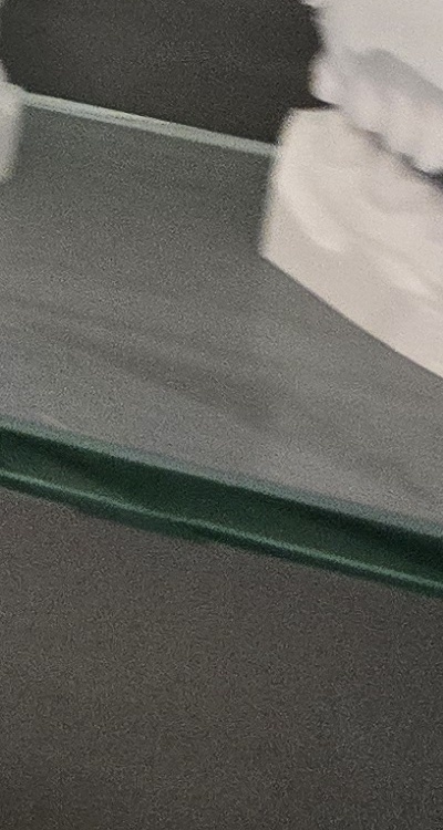 윗니 전체 임플란트 뭐부터 해야할까 관련 이미지 48