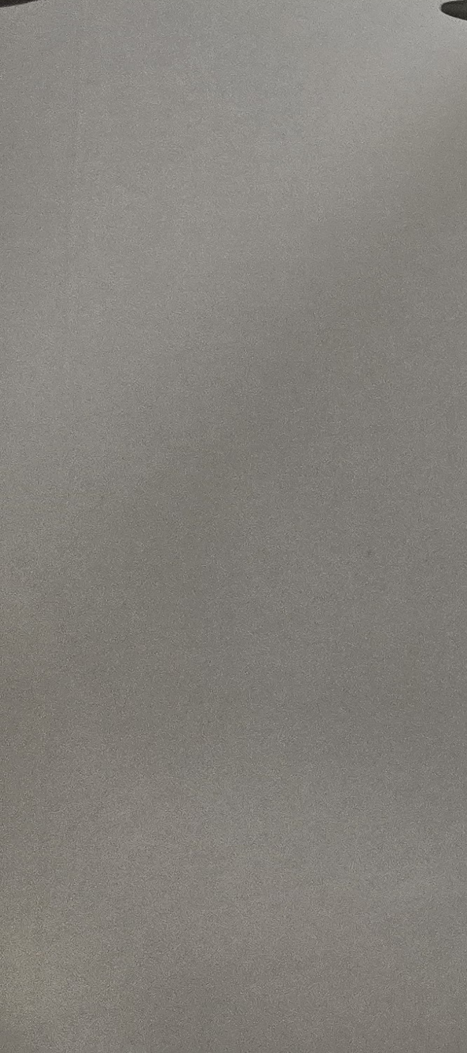앞니 돌출 교정 기간 자세하게 따져보면 관련 이미지 34